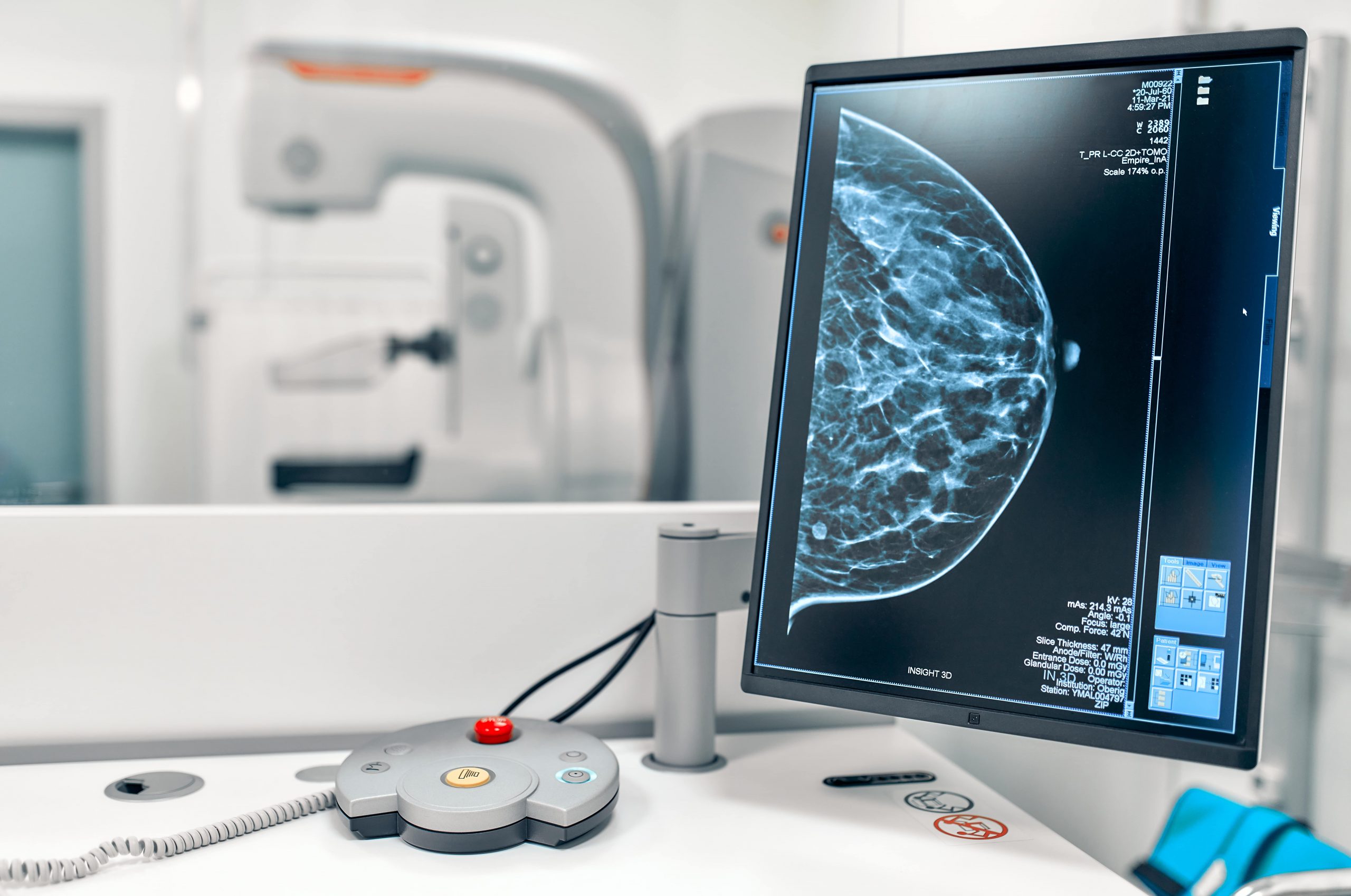Comparison Between Breast Cancer Ultrasound & Mammogram Treatment